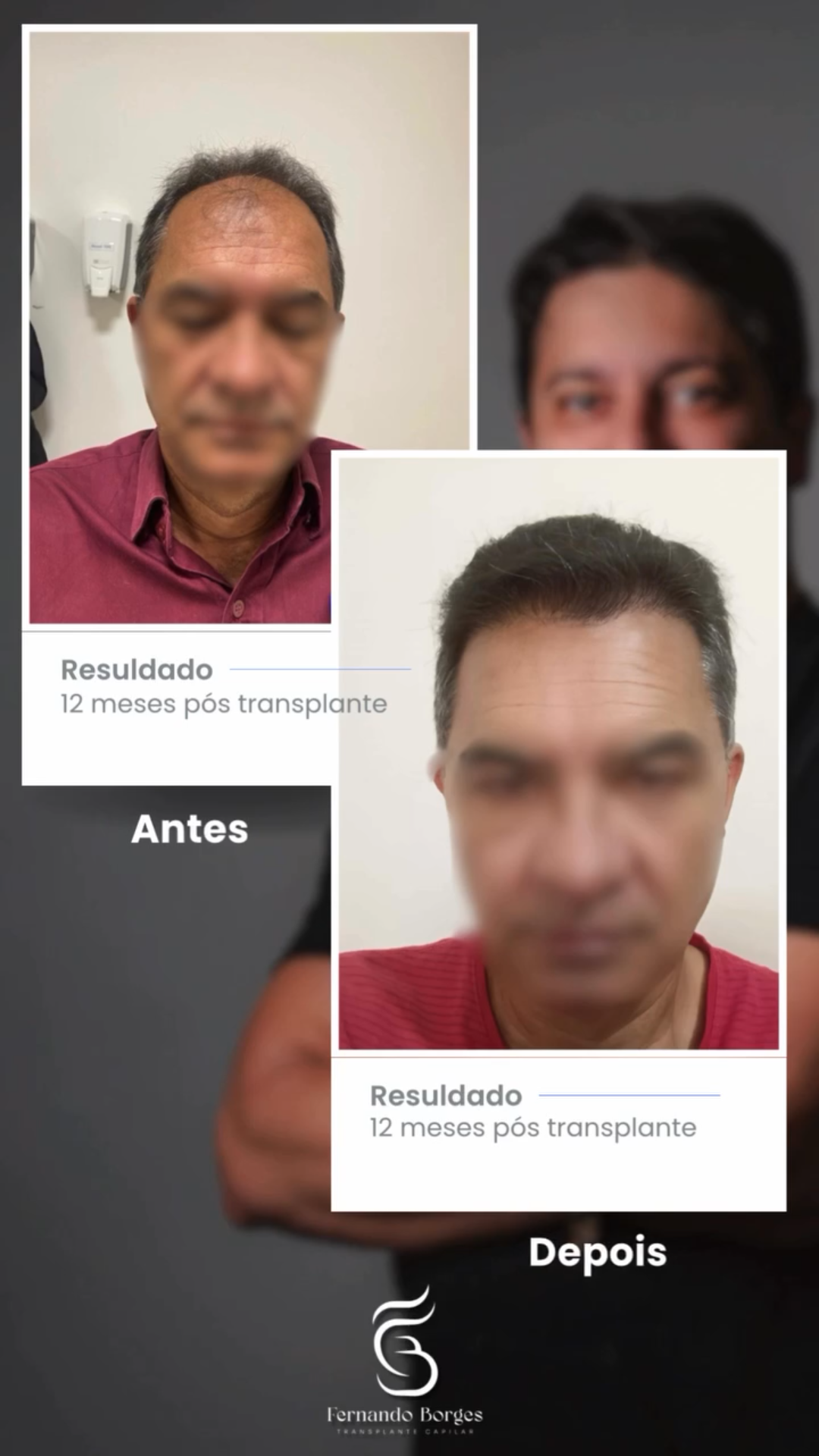 uploads/frames pro hair.png